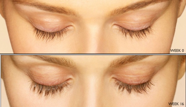 What is Latisse and How Does it Work? What is Latisse and How Does it Work?