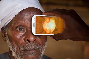 Using Smartphones to Fight Blindness