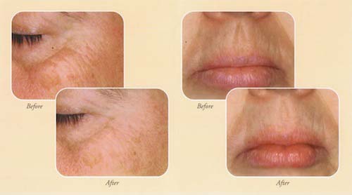 Botox and Aesthetics Skin Rejuvenation