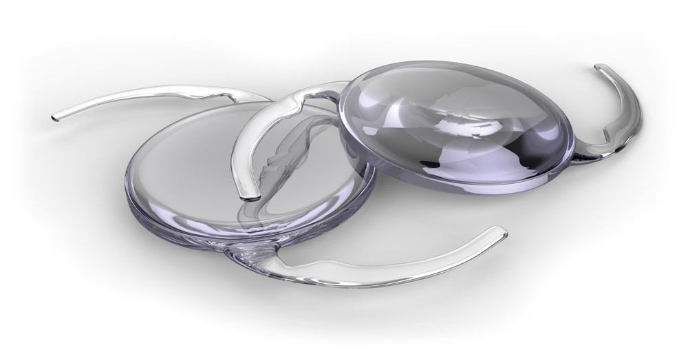 What is AN IOL? IOL technology in Florida