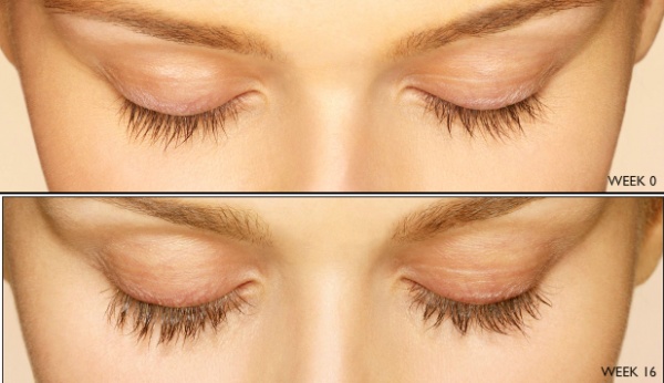 Eyelash Treatment with Latisse