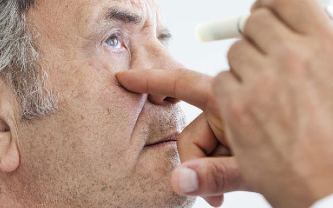 Signs You May Have A Cataract