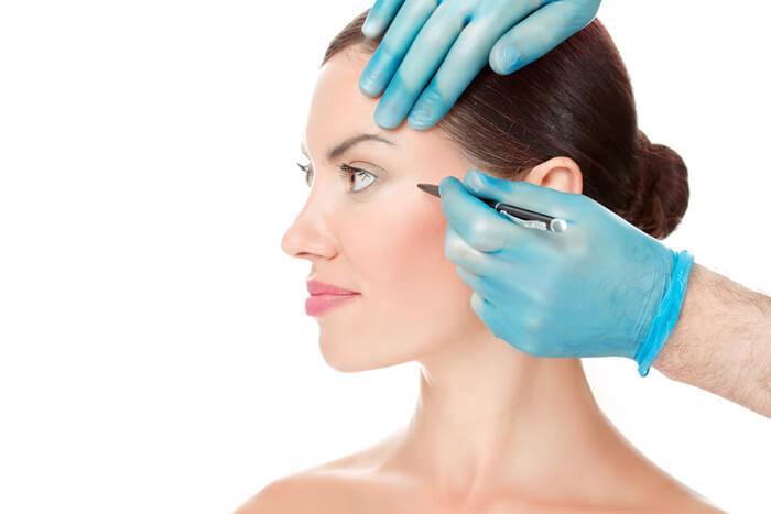What Happens During a Brow Lift?